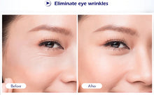 Load image into Gallery viewer, 💋💋5 in 1 Face Lifting Tighten Skin Rejuvenation Wrinkle Removal Device💋💋